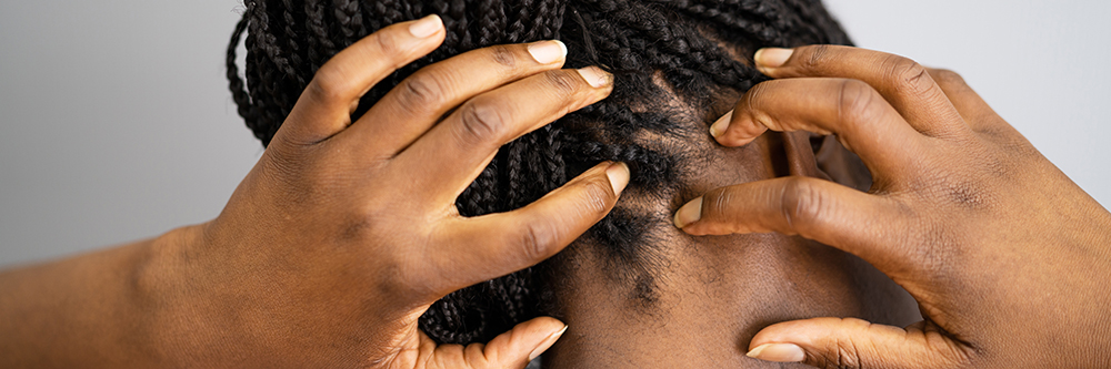 scalp itching black patients decatur