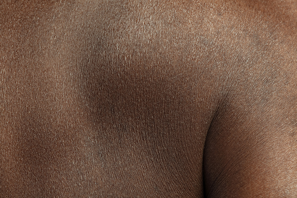 Dry Skin Treatment Black Skin